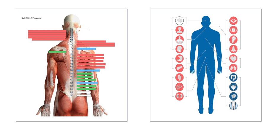 When Behaviour Speaks: How Chiropractic Helps Children Move Towards Calm, Focus & Regulation 7 Thermal Scans