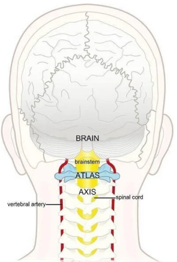 Why the Top of Your Spine Could Be the Key to Relieving Headaches and Migraines Naturally 1 CCJ