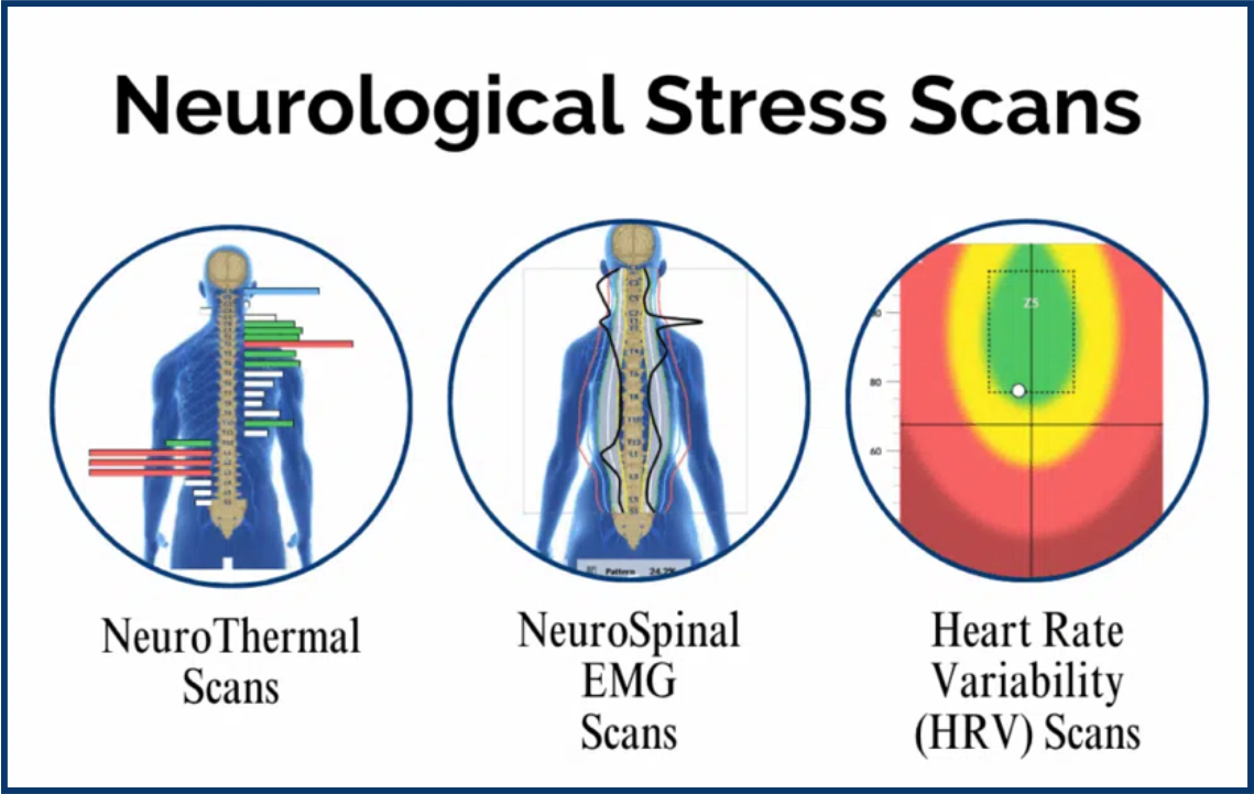 Dizziness & Vertigo: Understanding the Nervous System Connection 6 Neurological Stress Scans