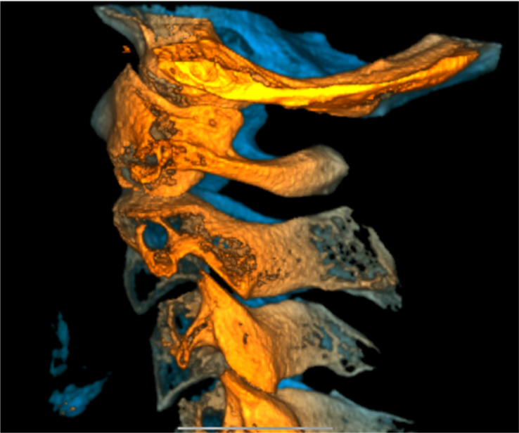 Dizziness & Vertigo: Understanding the Nervous System Connection 8 Spine left 1